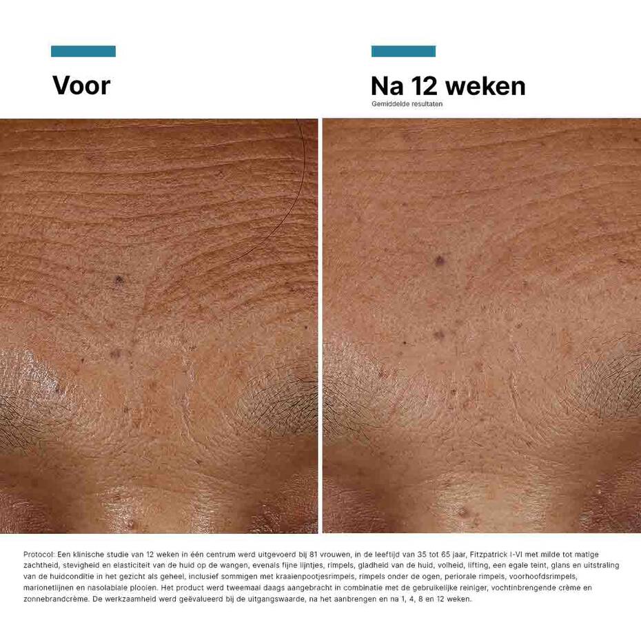 SkinCeuticals HA Intensifier Multi-Glycan